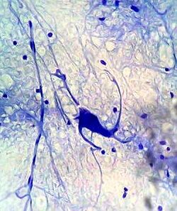 Neuron under microscope