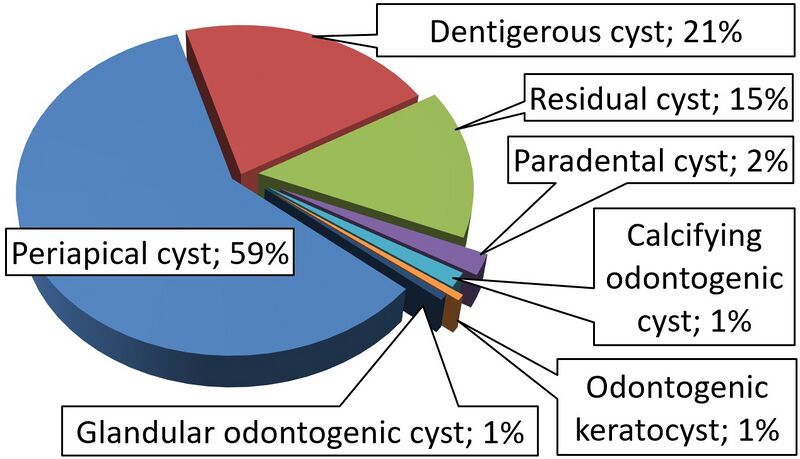 File:Relative incidence of odontogenic cysts.jpg