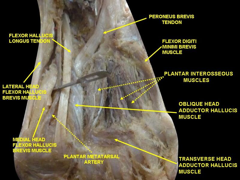 File:Slide1ABBBA.JPG