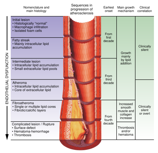 File:Atherosclerosis timeline - endothelial dysfunction.svg