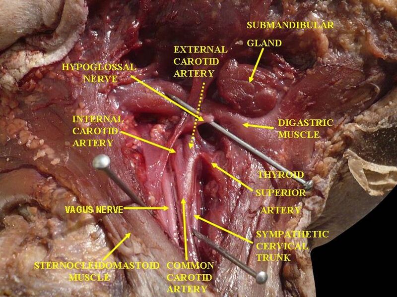 File:Slide1EBAB.JPG