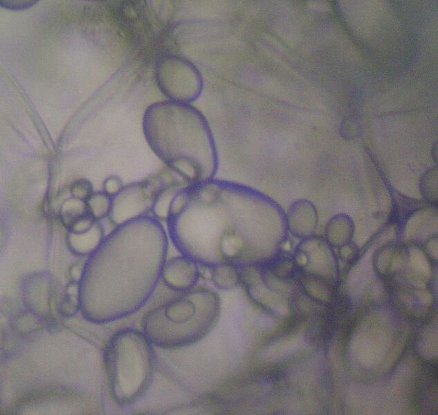 File:Potato - Amyloplasts.jpg