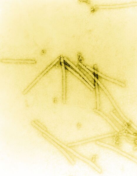 File:TobaccoMosaicVirus.jpg