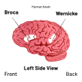 Diagram of Broca's and Wernicke's areas in the brain