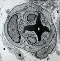 Pericyte