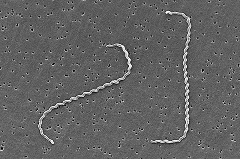 File:Leptospira interrogans strain RGA 01.png