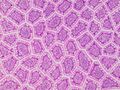 Intestinal villus