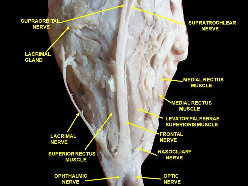 File:Slide4abab.JPG