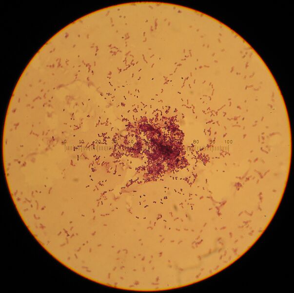 File:Lactococcus lactis.jpg