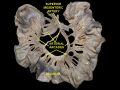 Intestinal arteries