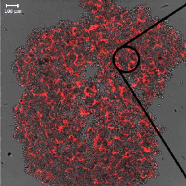 File:Breast cancer spheroids with aptamers.png