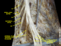 Histological slide showing the dura mater