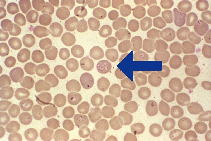 File:Babiesa spp.jpg