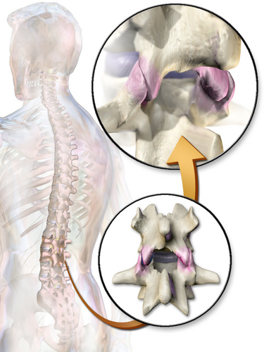 File:Facet Joints.png