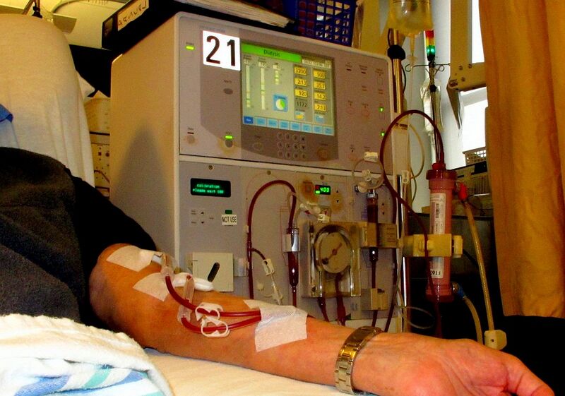 File:Dialysis - arm - 01.jpg