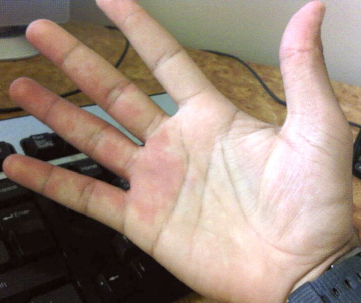 File:Myhand.jpg
