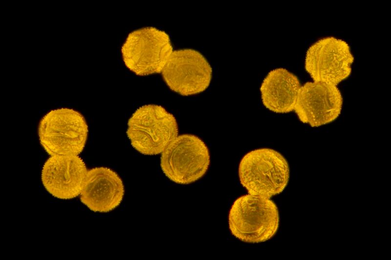 File:Pollen grains of Taraxacum.jpg