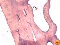 Bone decalcification at 40x magnification