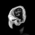 Parasagittal MRI of human head