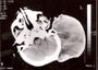 Thumbnail for version as of 22:28, 8 June 2026