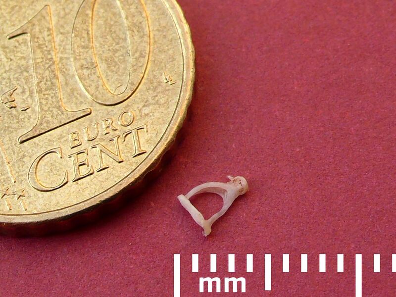 File:Stapes human ear.jpg