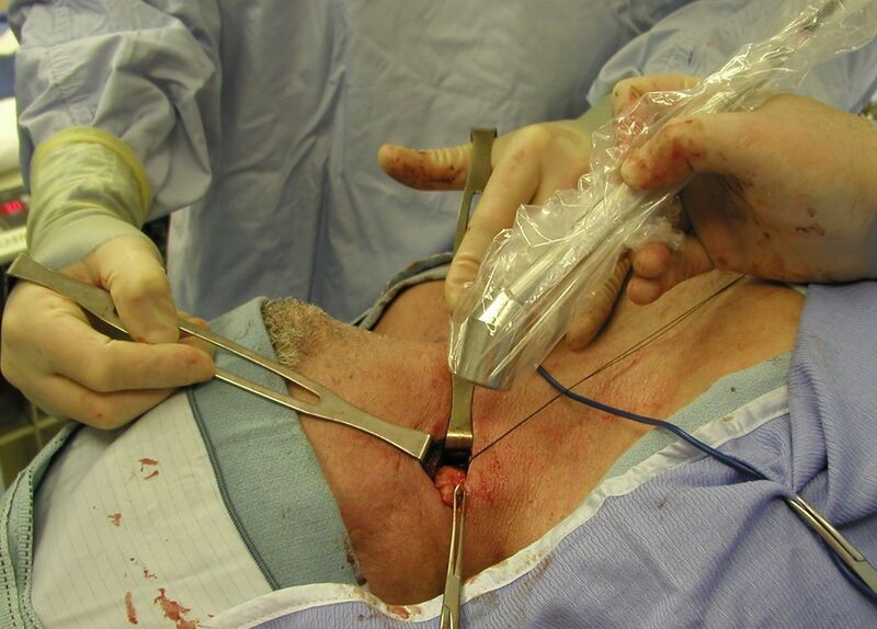 File:Lymph node NPC.jpg