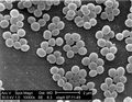 Neonatal_meningitis