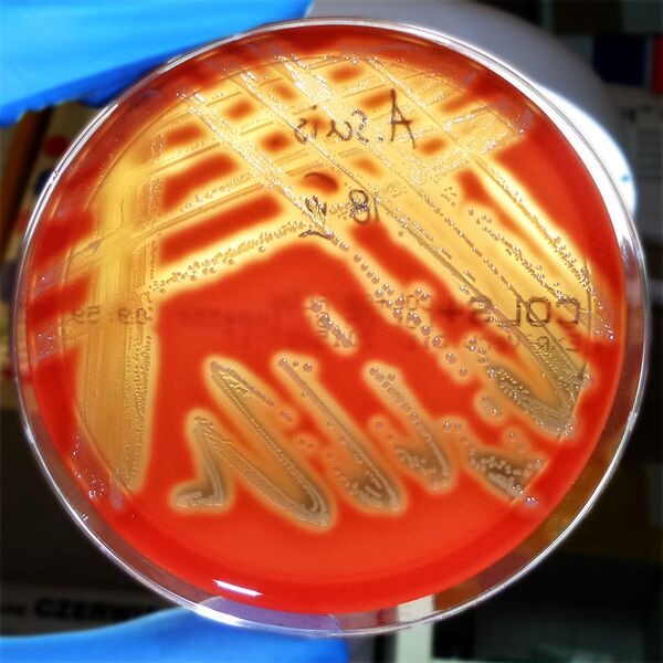 File:Actinobacillus suis colonies.jpg