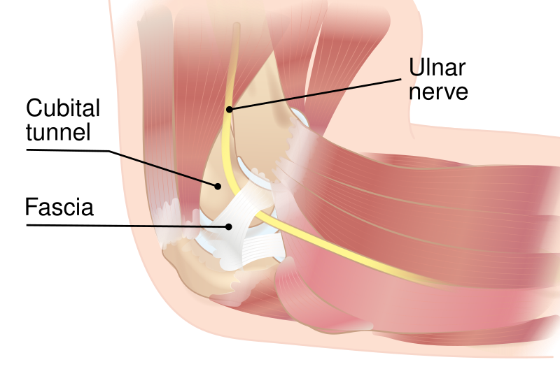 File:Compressed ulnar nerve.svg