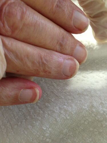 File:Terry's nails.jpg