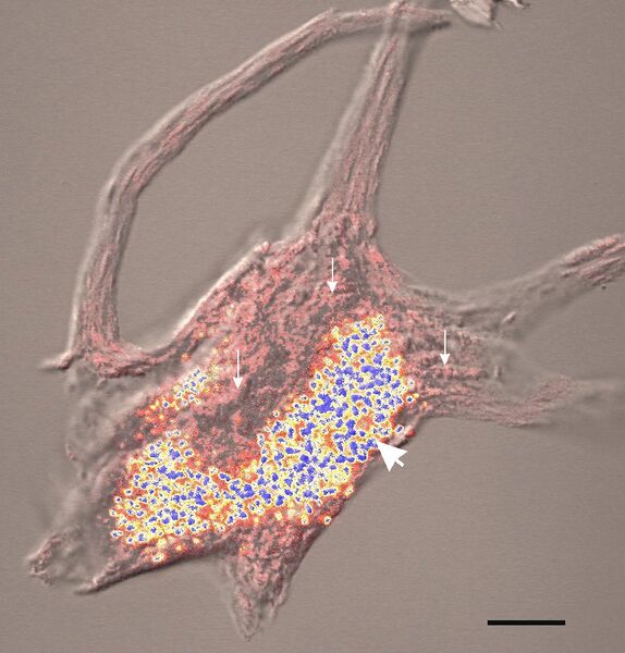 File:Lipofuscin neuro.jpg