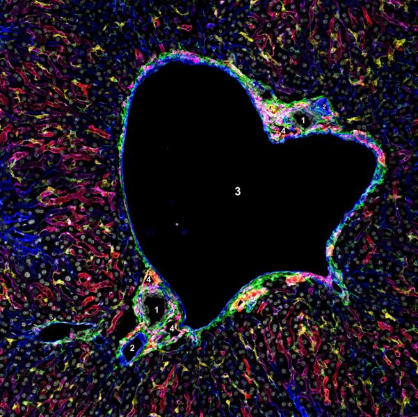File:Liver portal triad.png