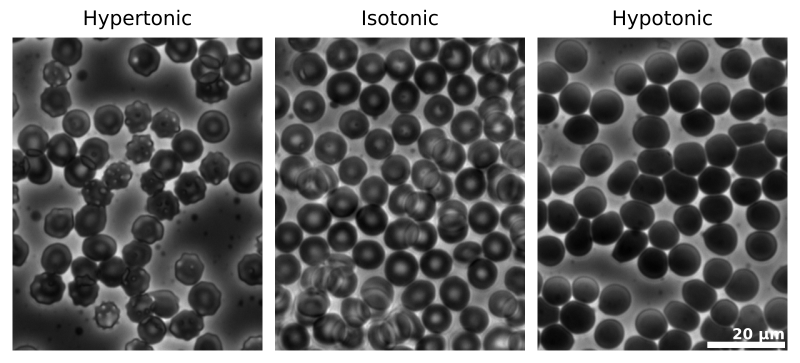 File:Human Erythrocytes OsmoticPressure PhaseContrast Plain.svg