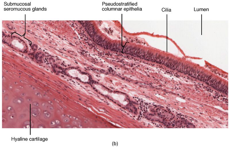 File:2308 The Trachea-b.jpg