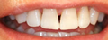Thumbnail for version as of 19:18, 4 June 2026