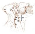 Illustration of lymph chain