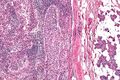 Thumbnail for version as of 22:36, 8 June 2026