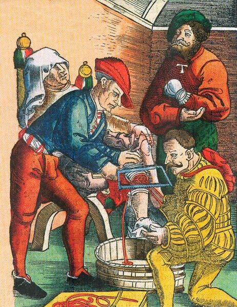 File:Amputation 1540.jpg