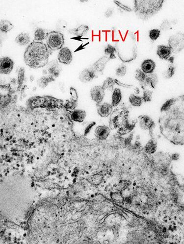 File:HTLV-1 EM 8241 lores.jpg