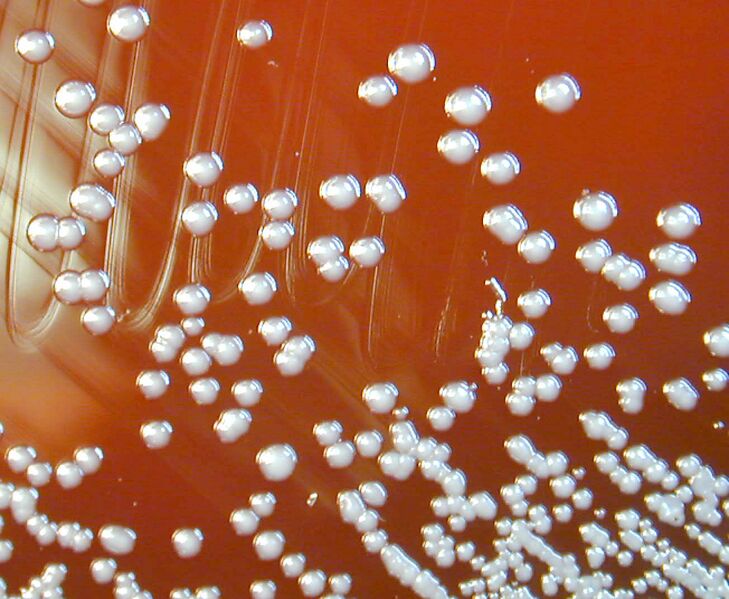 File:Burkholderia pseudomallei 01.jpg