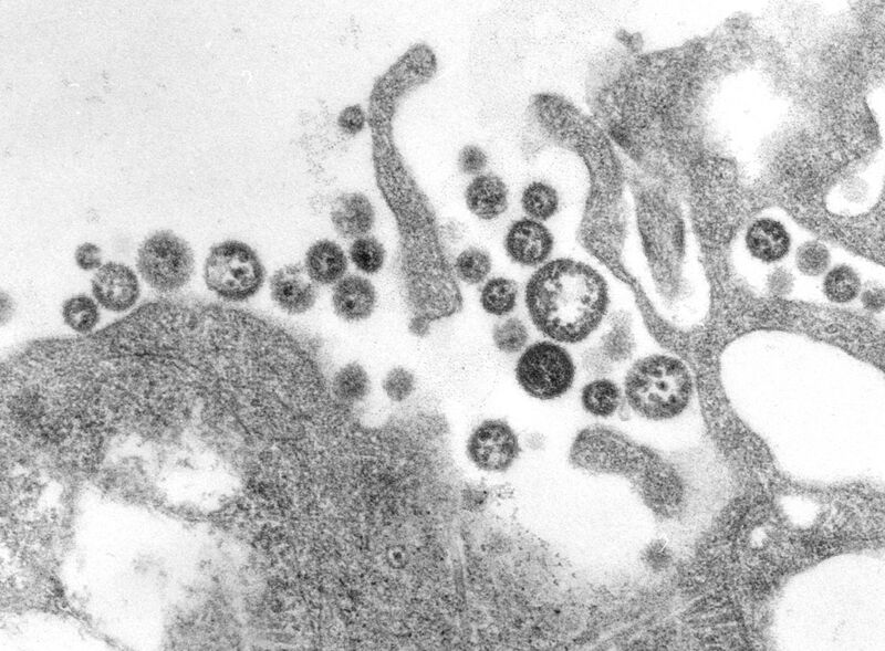 File:Lassa virus.JPG