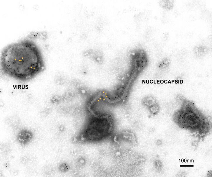 File:CSIRO ScienceImage 1719 Hendra Virus.jpg
