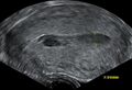 Thumbnail for version as of 16:24, 1 June 2026