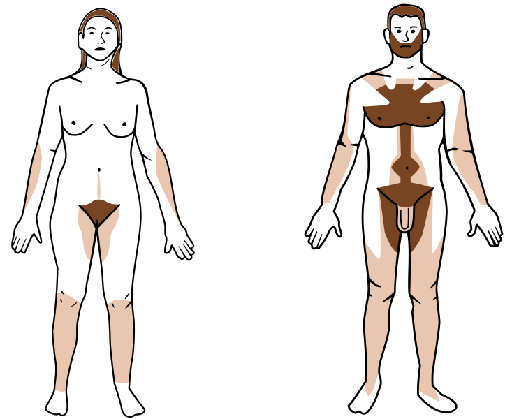 File:Androgenic hair.svg