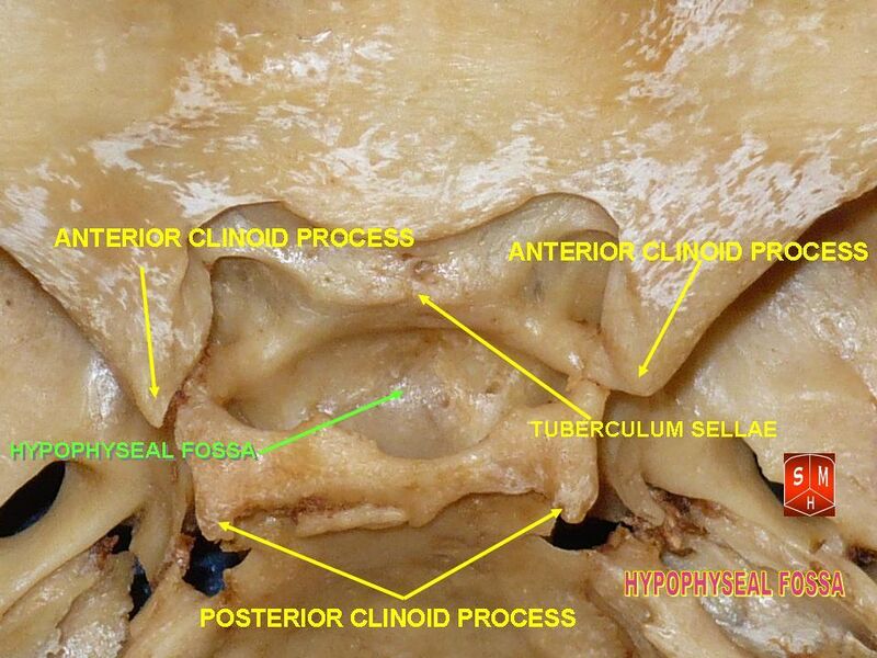 File:Base of skull 8.jpg