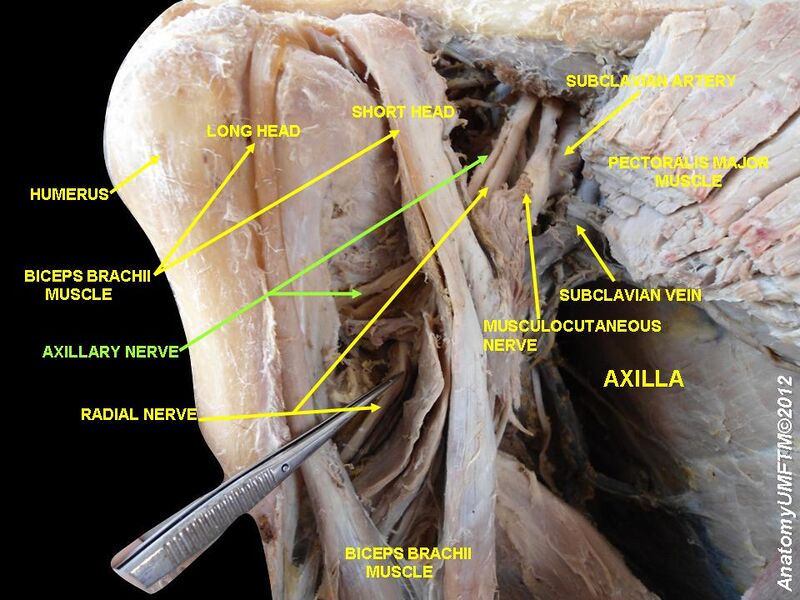 File:Slide12dj.JPG