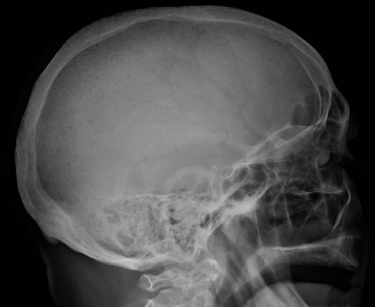 File:MMPlainSkull.png
