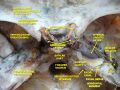 Dissection of the occipital bone