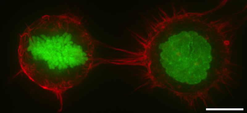 File:Actin-cortex.png