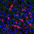 Serotonin transporter 1 in green, tyrosine hydroxylase in red and nuclear DNA in blue in a region of rat brain